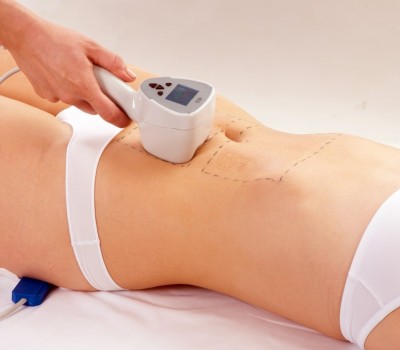 Radiofrequenza BTL Exilis System